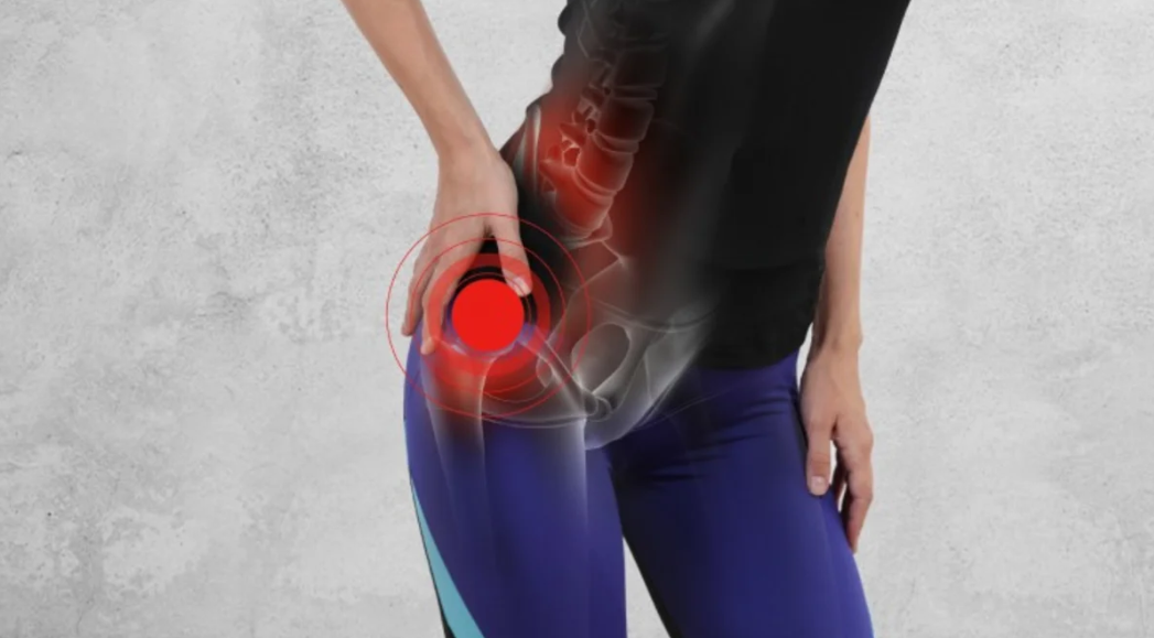mujer con animación de dolor de cadera