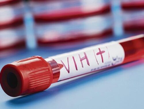 tubo de sangre para prueba de vih