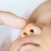 bebé con galactosemia