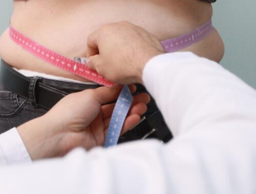 doctor midiendo abdomen de paciente mujer